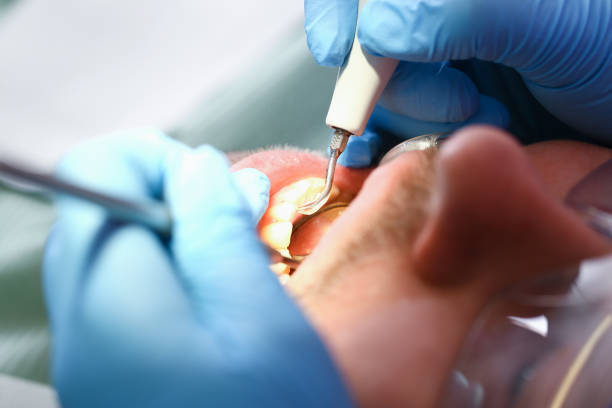 Best Mobile Emergency Dentist in Vernon Hls, IL