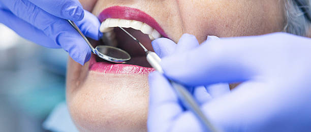 Best Emergency Dental Care for Abscessed Tooth in Vernon Hls, IL